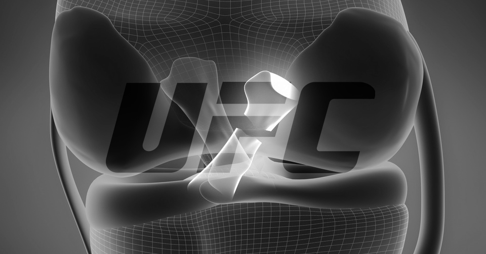 Czarna seria trwa, kolejna kontuzja w UFC