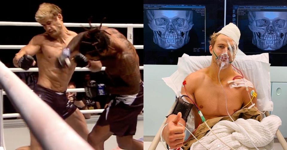 Bolesny debiut Sage’a Northcutta dla ONE Championship. Zawodnik doznał złamań czaszki w wielu miejscach.