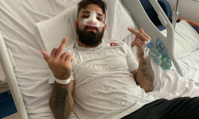 mike-perry-nose-ufc-on-espn-plus-14