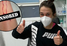 „Więc chcesz być zawodnikiem?” – Joanna Jędrzejczyk pokazuje kontuzjowaną nogę