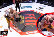 „Ból przeszył całe ciało…” – Dominik Zadora o przyczynach przegranej na FEN 37