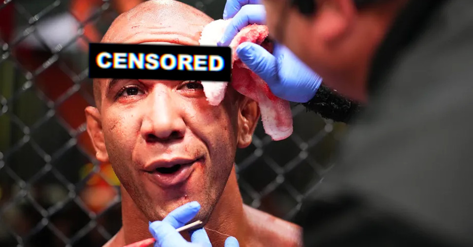 Okropne rozcięcie głowy Rodriguesa po zwycięskiej walce na UFC Vegas 60