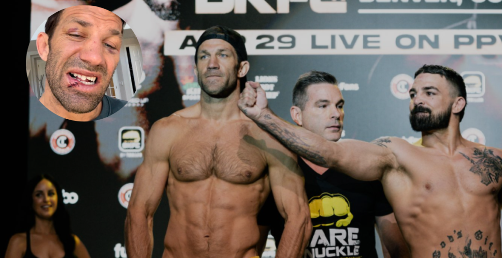 Luke Rockhold po nieudanej walce na gołe pięści: „Jakieś rękawice byłyby spoko”