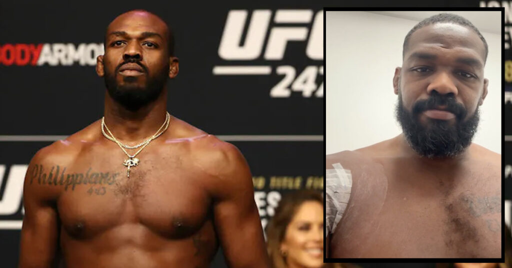 Jon Jones przeszedł operację kontuzjowanego barku