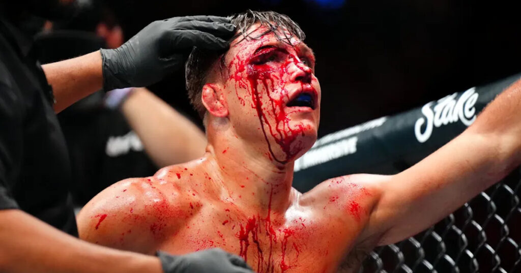 Drew Dober zabiera głos po okropnym rozcięciu na UFC Denver