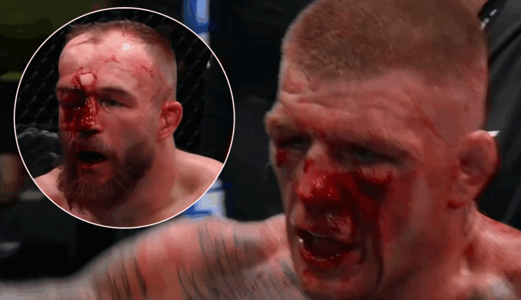 UFC Vegas 108: Chris Duncan przetrwał piekło i wypunktował Mateusza Rębeckiego po brutalnej wojnie na wyniszczenie! UFC Vegas 108: Chris Duncan przetrwał piekło i wypunktował Mateusza Rębeckiego po brutalnej wojnie na wyniszczenie!