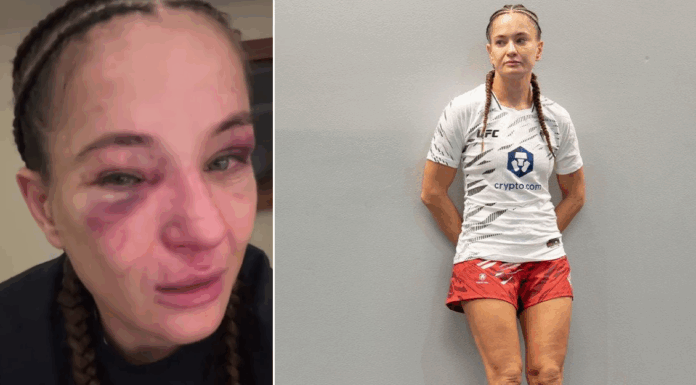 Karolina Kowalkiewicz zabiera głos po porażce w UFC: „Nie mam wymówek, rywalka była lepsza”