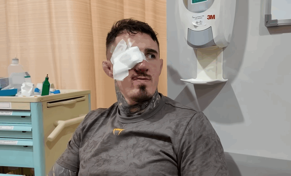 Tom Aspinall wściekły po UFC 321: „Jak on nie został zdyskwalifikowany?” – mistrz przekazuje informacje na temat uszkodzonego oka Tom Aspinall wściekły po UFC 321: „Jak on nie został zdyskwalifikowany?” – mistrz przekazuje informacje na temat uszkodzonego oka