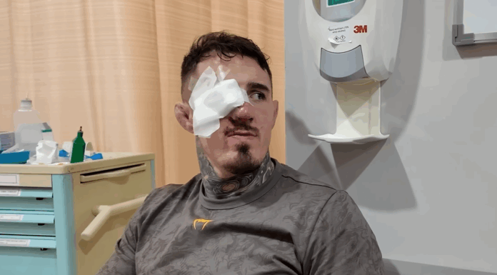 Tom Aspinall wściekły po UFC 321: „Jak on nie został zdyskwalifikowany?” – mistrz przekazuje informacje na temat uszkodzonego oka