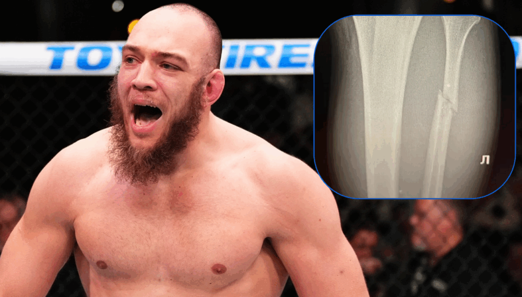 Valter Walker ujawnia kontuzję po UFC 321: złamana kość strzałkowa mimo błyskawicznego zwycięstwa!