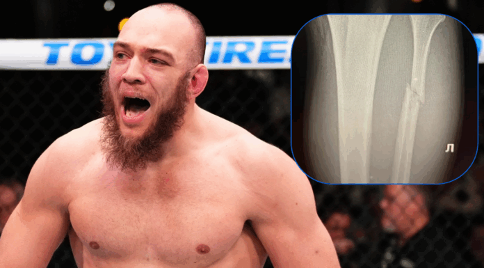 Valter Walker ujawnia kontuzję po UFC 321: złamana kość strzałkowa mimo błyskawicznego zwycięstwa!