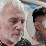 Tom Aspinall nadal nie widzi na jedno oko po UFC 321. Ojciec mistrza komentuje dramatyczny uraz