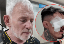 Tom Aspinall nadal nie widzi na jedno oko po UFC 321. Ojciec mistrza komentuje dramatyczny uraz