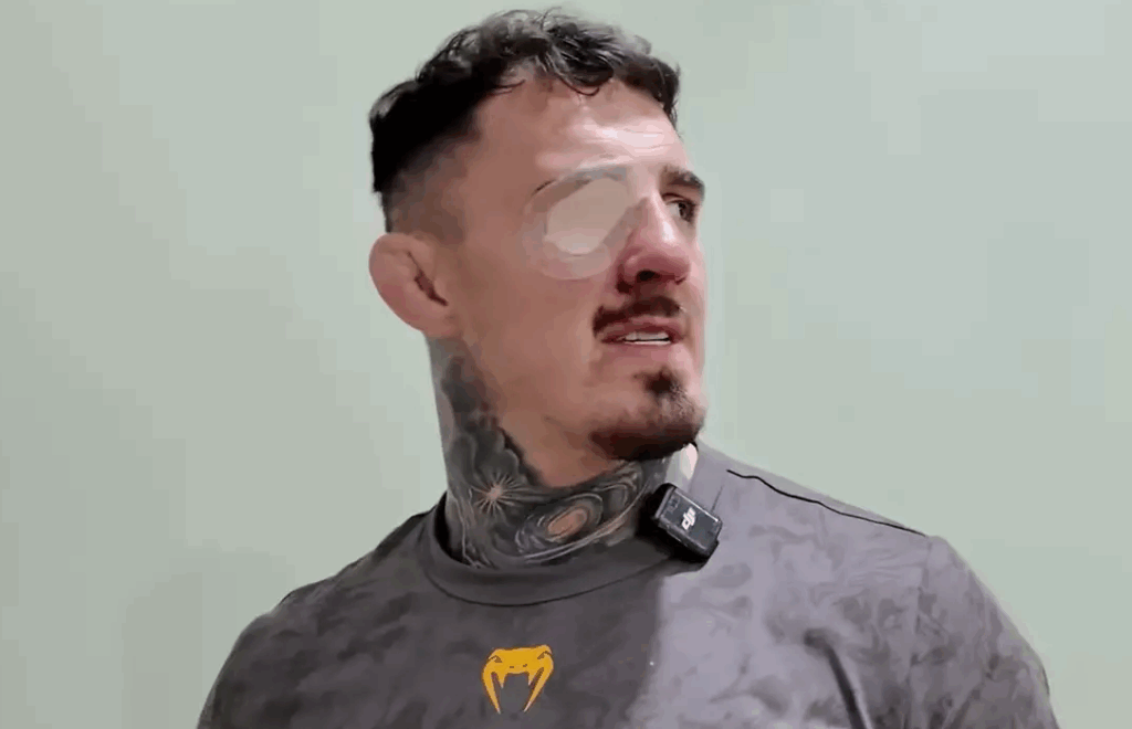 Tom Aspinall ujawnia diagnozę po UFC 321. Poważny uraz oczu i brak zgody na walkę
