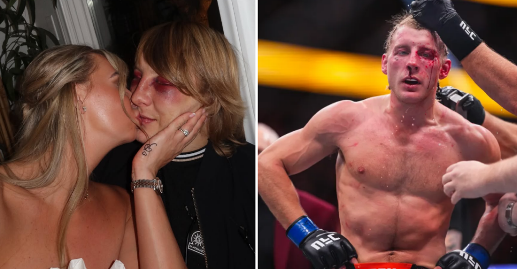 Paddy Pimblett i jego żona przerywają ciszę w mediach po przegranej na UFC 324