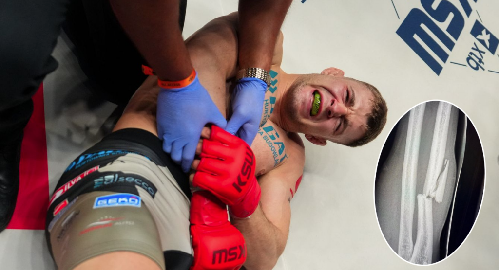 Potworna kontuzja Wojciecha Kawy po XTB KSW 116. Zawodnik ujawnia uraz