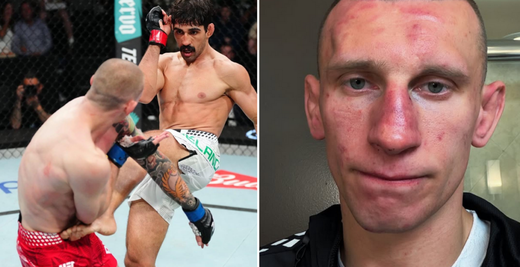 Robert Ruchała zabrał głos po drugiej porażce w UFC