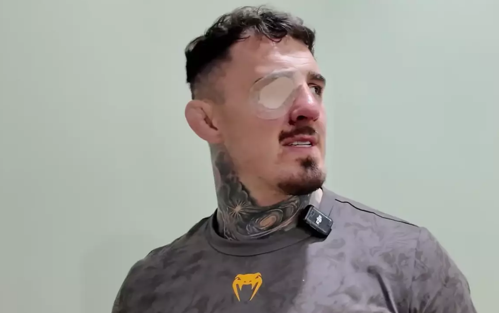 Tom Aspinall o koszmarnych operacjach oka: „W porównaniu z tym wazektomia to nic” Tom Aspinall o koszmarnych operacjach oka: „W porównaniu z tym wazektomia to nic”